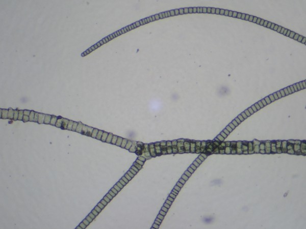 Staghorn
              algae under the microscope