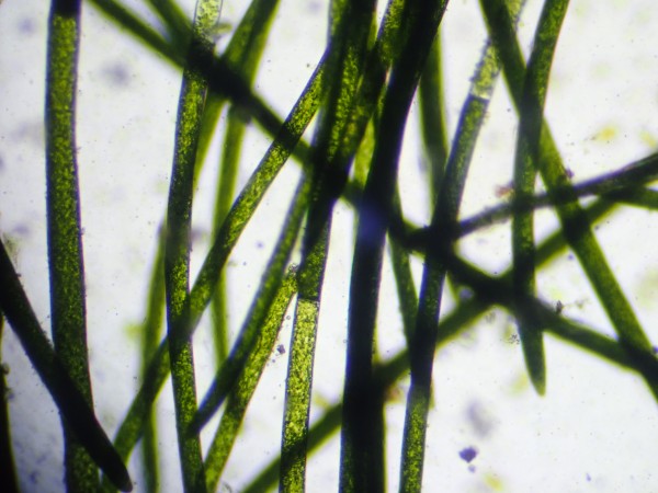 Vaucheria
              under microscope